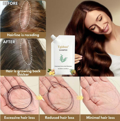 Rosemary Amino Acid Shampoo — Revitalize Hair Follicles, Say Goodbye to Hair Loss, Promote New Hair Growth, and Reclaim Fuller Hair and Confidence